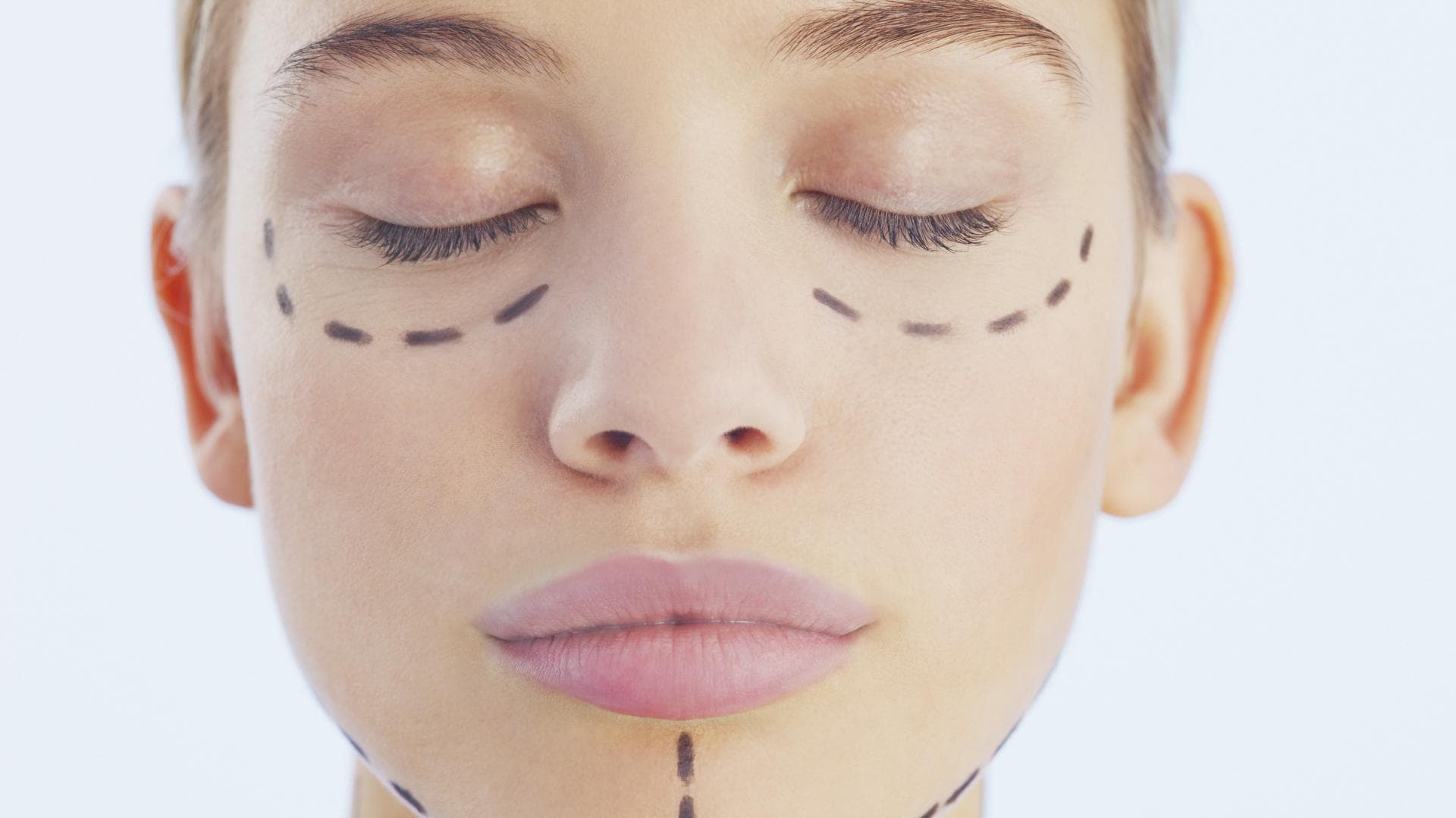 Frau mit Strichen vor Beauty OP im Gesicht
