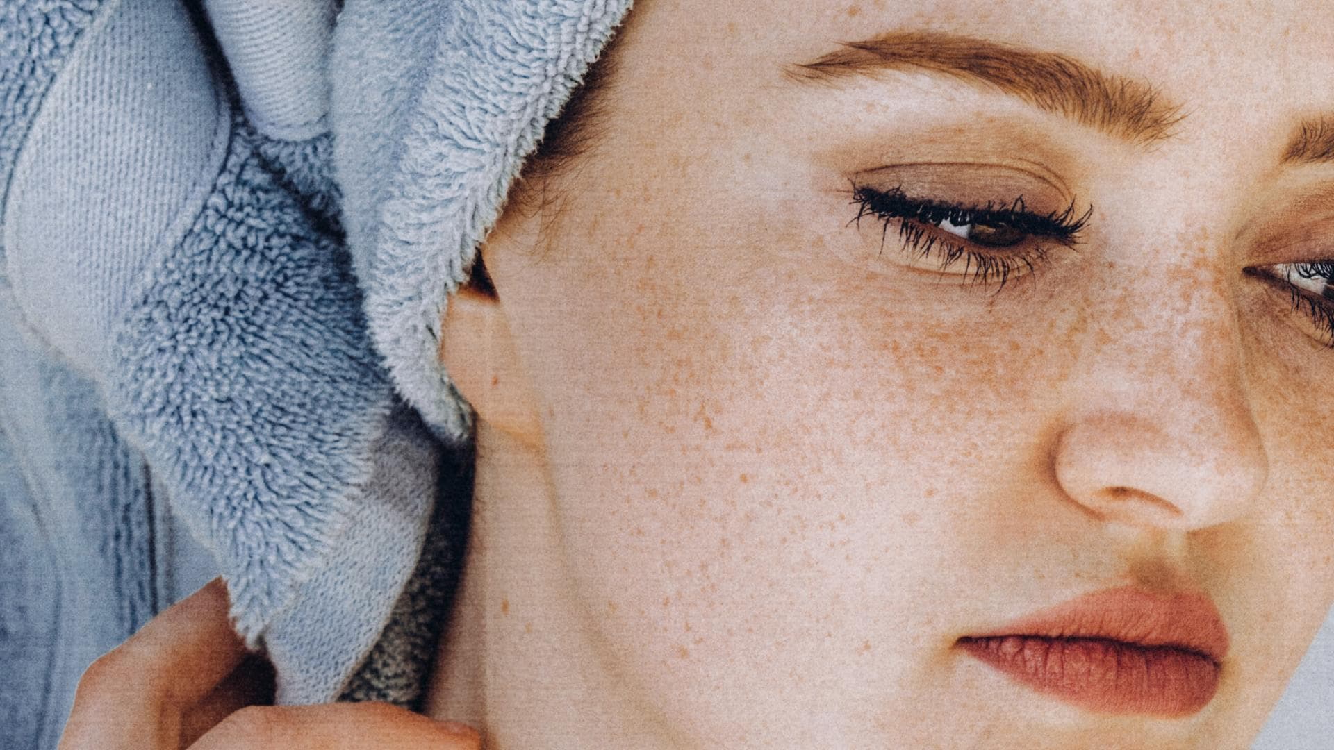 Kartoffeln gegen Akne