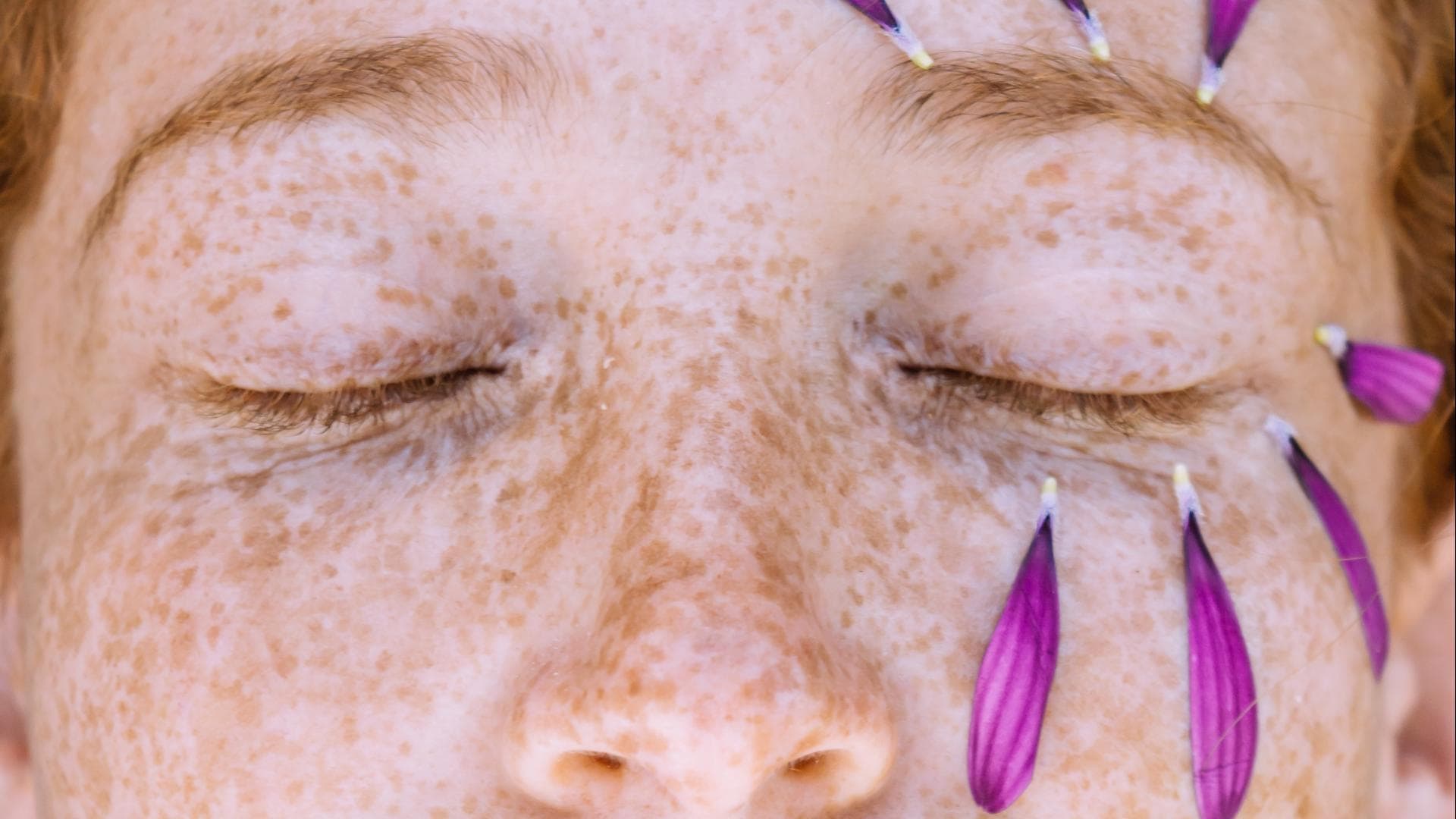 Frau mit Sommersprossen