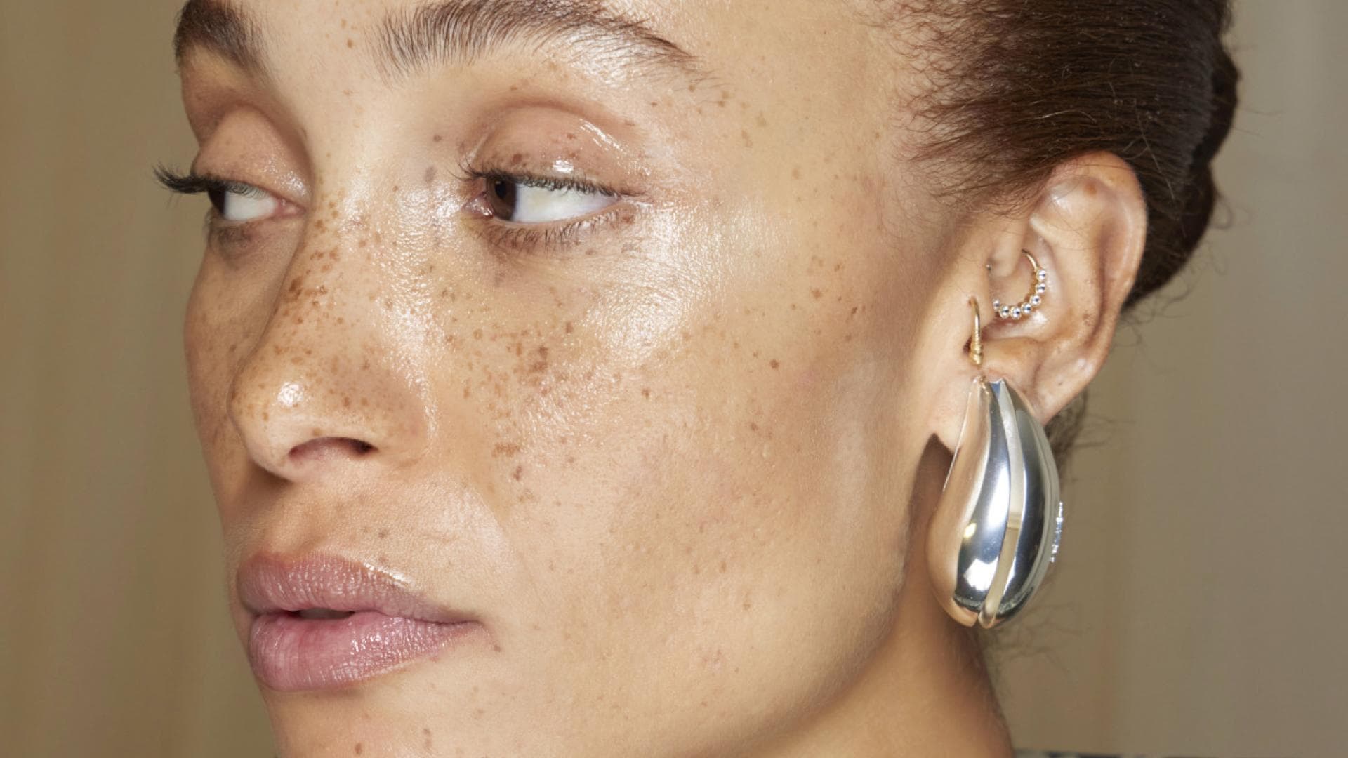 Freckles