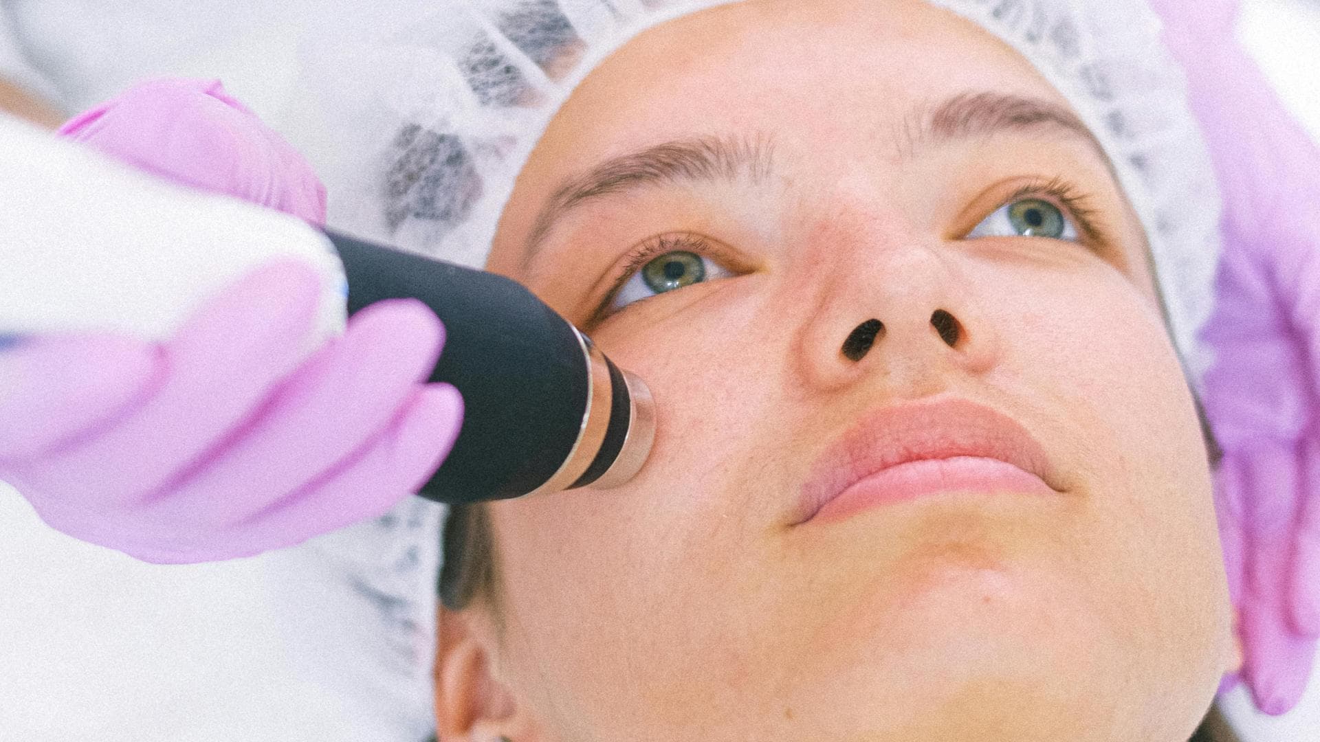 Anwendung der Hydradermabrasion Gesichtsbehandlung
