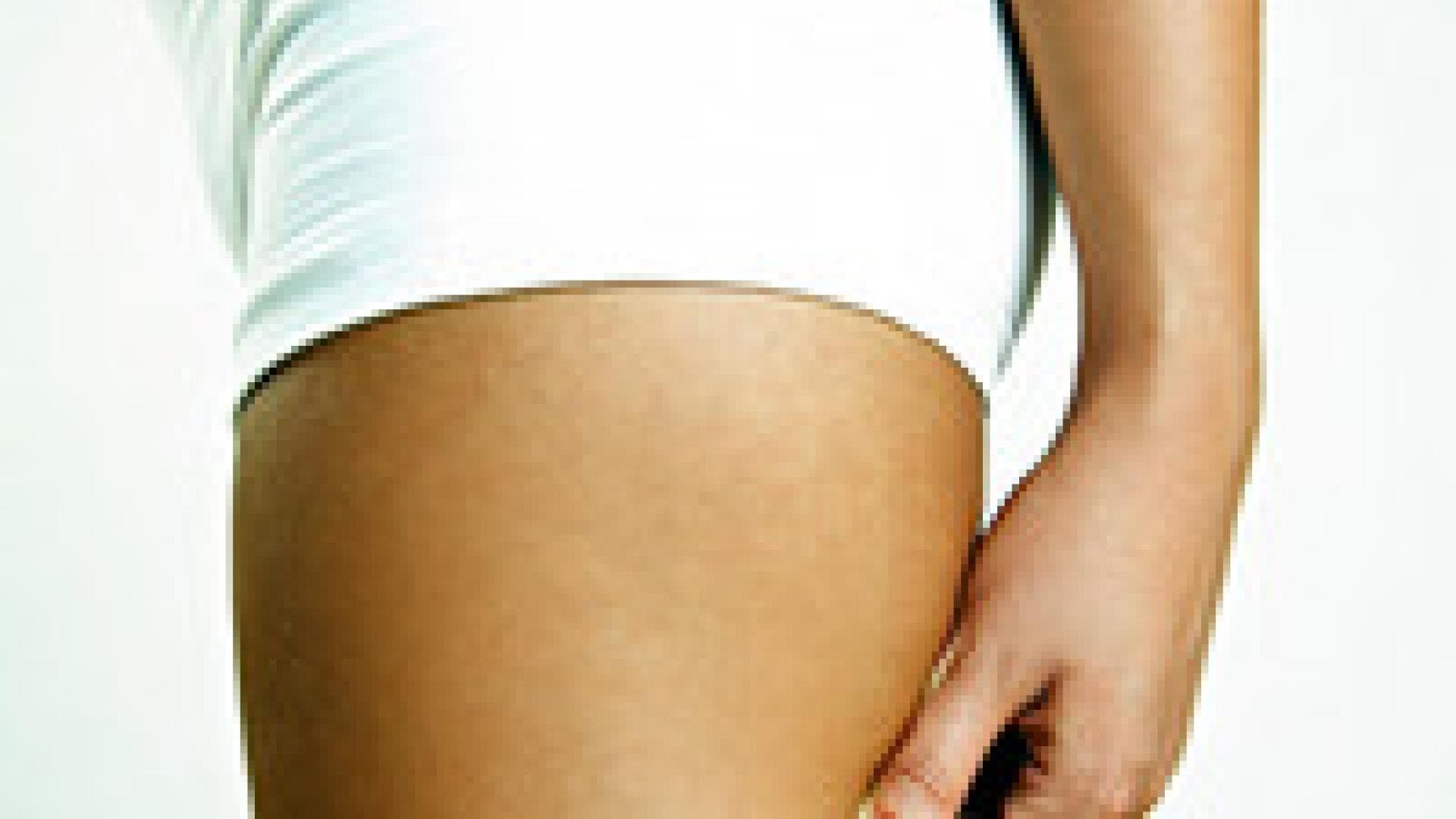 10 verbreitete Cellulite-Mythen