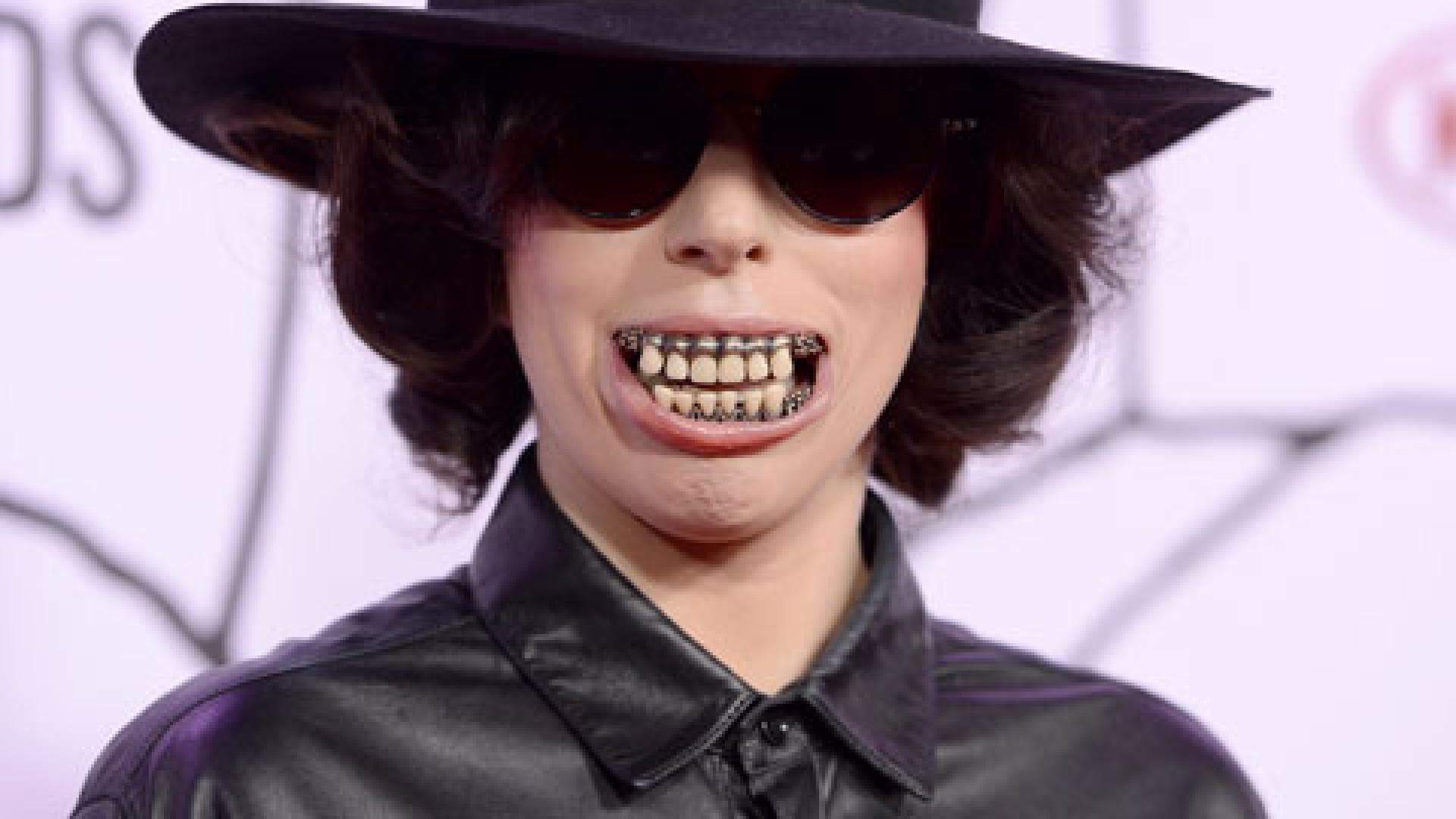 lady-gaga-zaehne-480x400-1880559.jpg