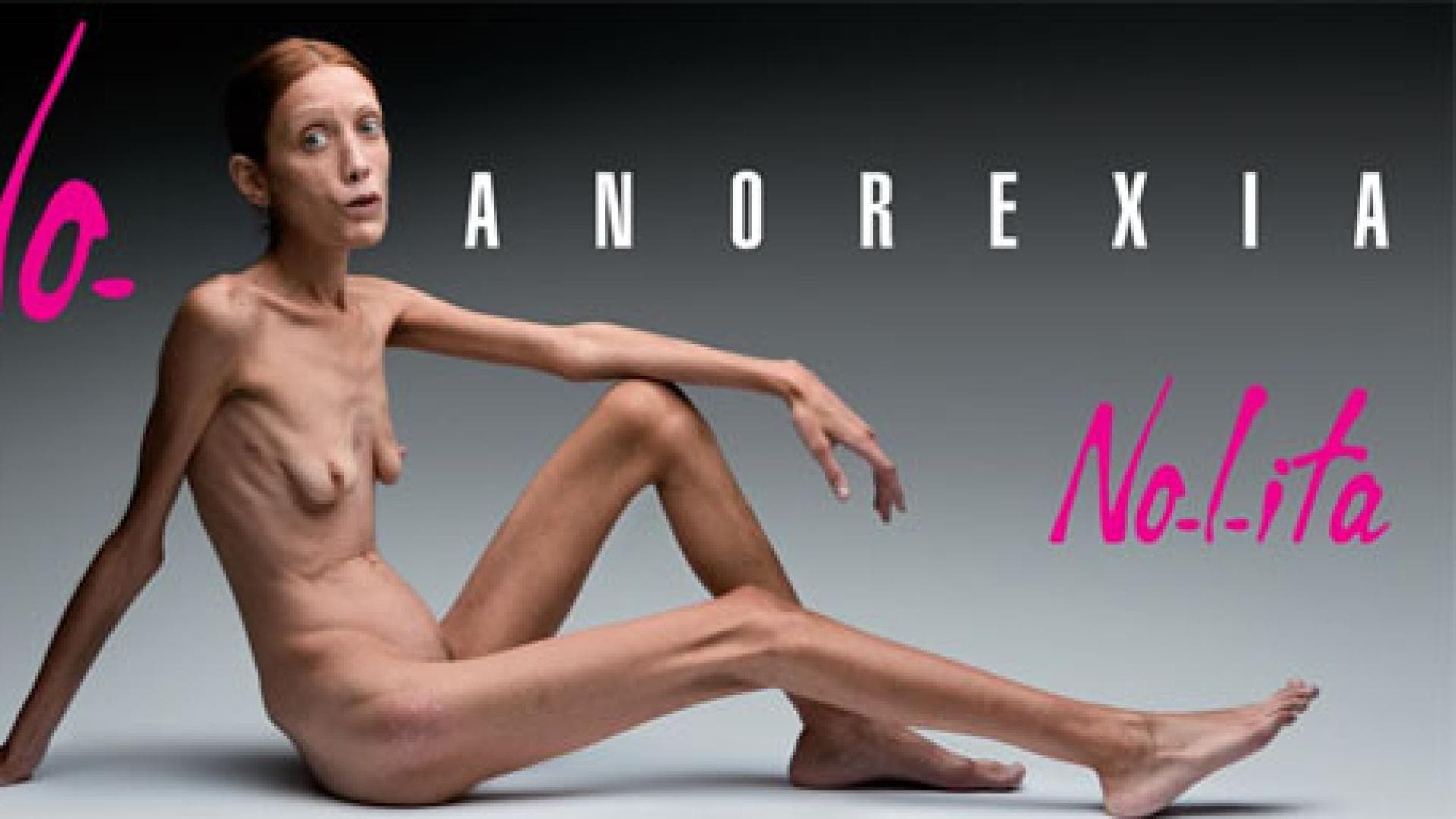 nolitas-aktuelle-kampagne-no-anorexia-www-nolita-it-520x257-9851.jpg