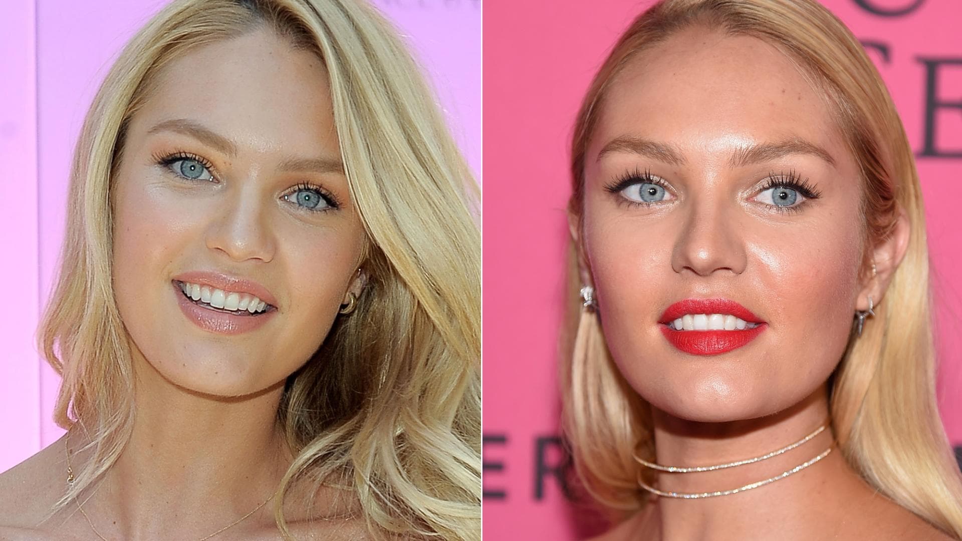 Die Zähne der Stars