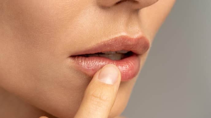 Frau mit Herpes an der Lippe