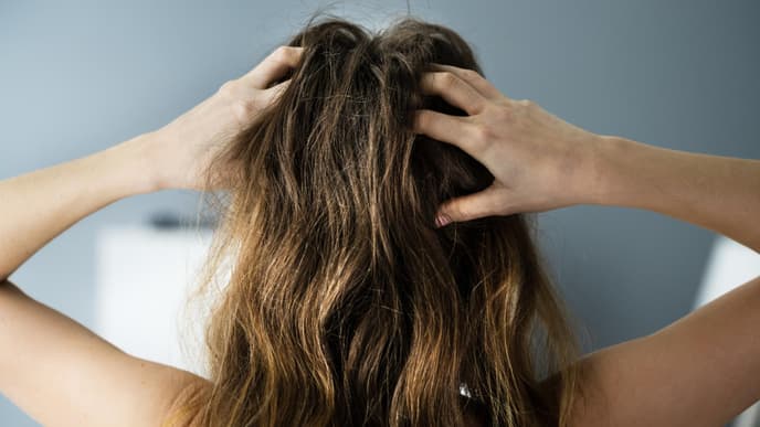 Schuppige Kopfhaut Frau
