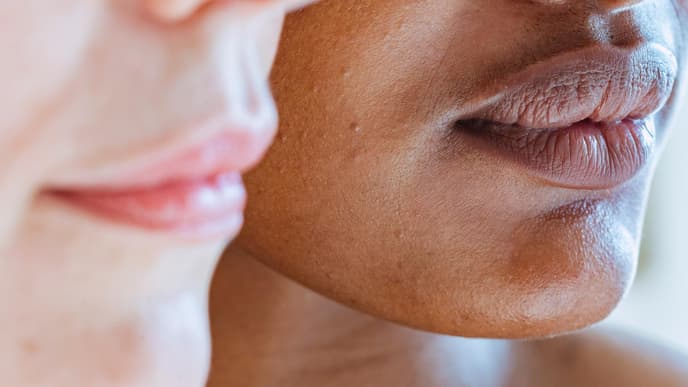 Frauen mit Sebaceous Filaments