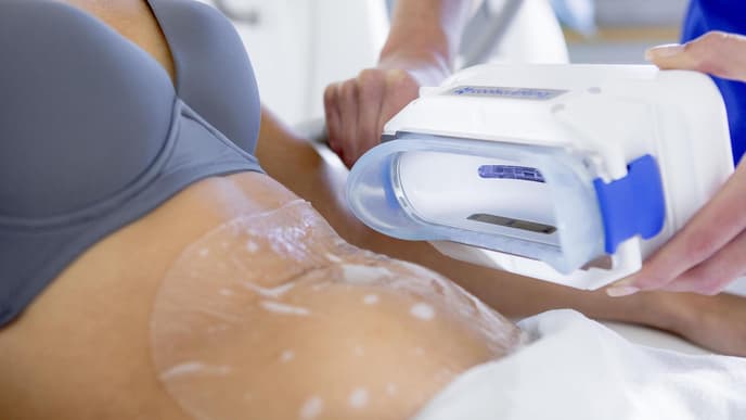 CoolSculpting Behandlung