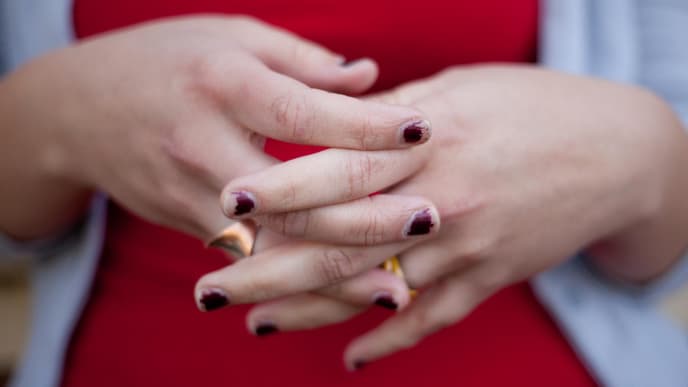 Abgesplitterter Nagellack