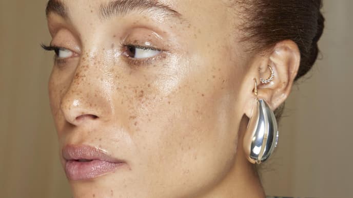 Freckles