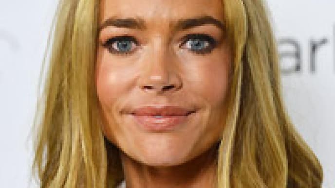 Tanorexia will nicht sterben