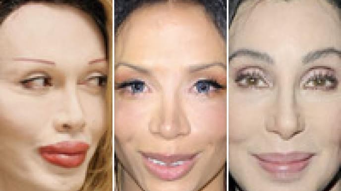 Botox: "A New Kind of Beauty"