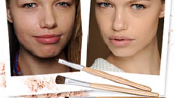 Unreine Haut: So tricksen Models