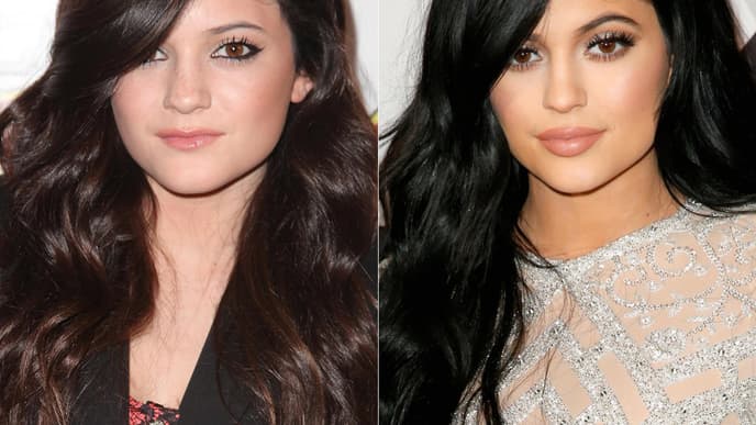 The Kardashians