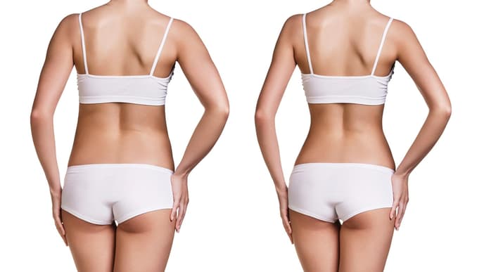 vorher-nachher-body