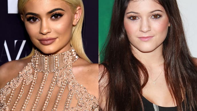 kylie jenner lippenfiller