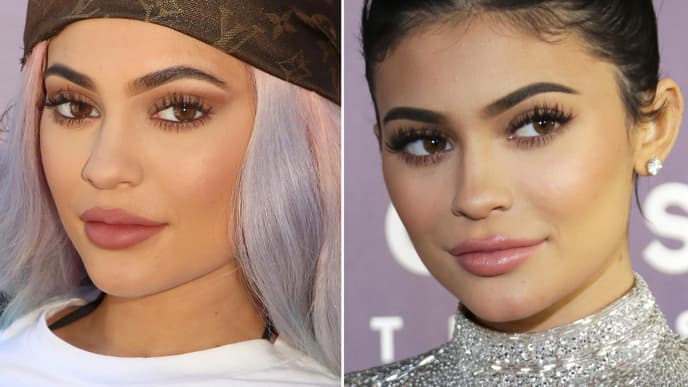 kylie-jenner-lippen-früher-heute