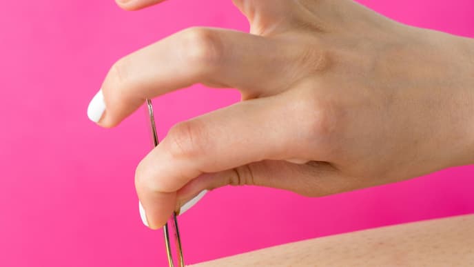 ingrown hair