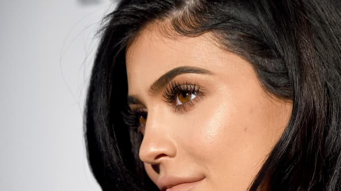 Kylie-Jenner-Lipfillers