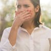 Periorale Dermatitis