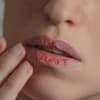 Brennende Lippen