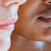Frauen mit Sebaceous Filaments