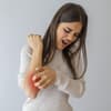 Frau kratzt sich am Arm