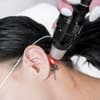 Tatto hinter dem Ohr wird gelasert