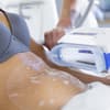 CoolSculpting Behandlung