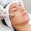 Microdermabrasion Behandlung