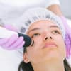 Anwendung der Hydradermabrasion Gesichtsbehandlung