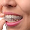 Invisalign