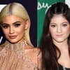 kylie jenner lippenfiller