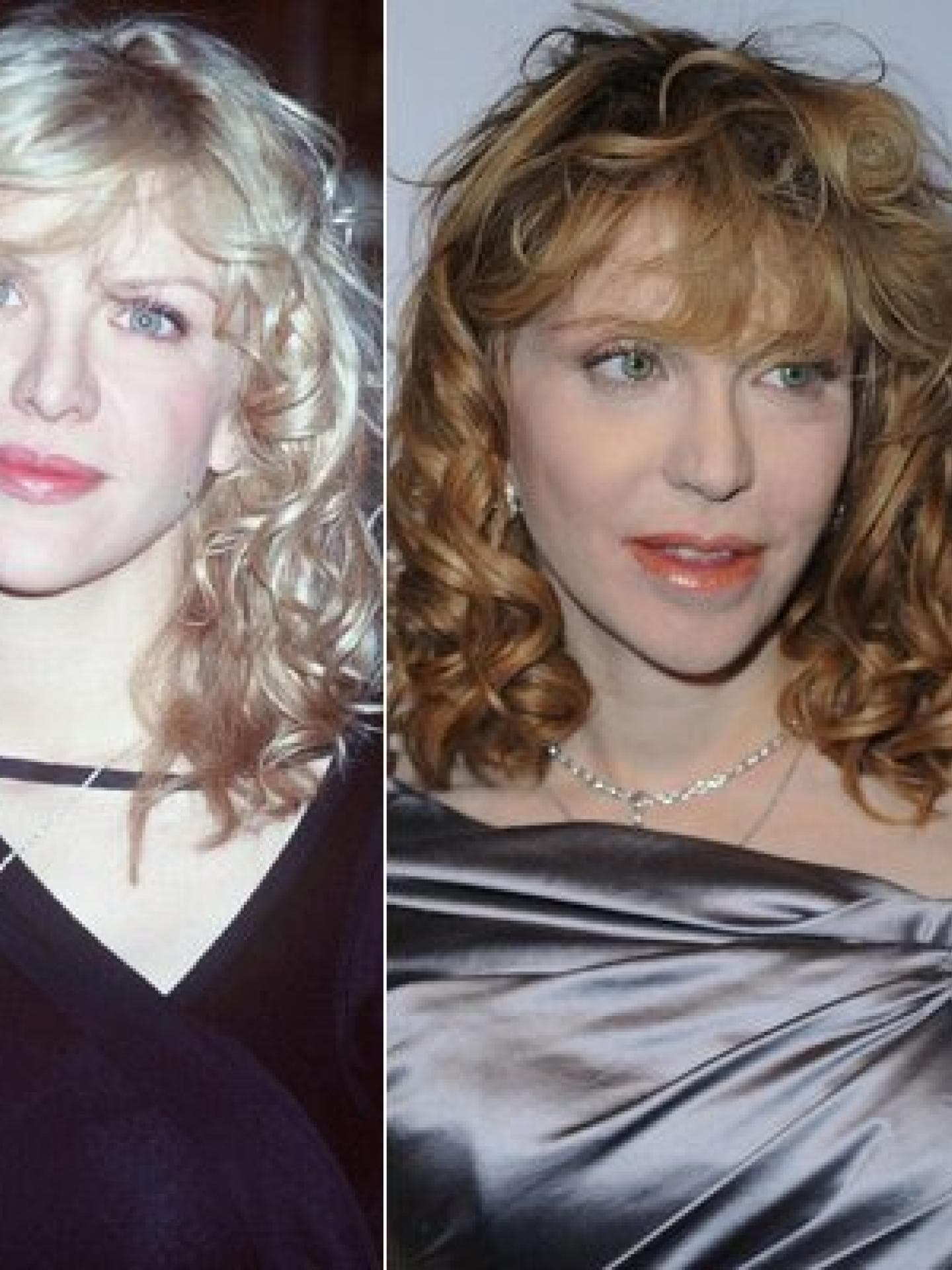 Courtney Love: Vorher-Nachher Courtney Love: Vorher-Nachher
