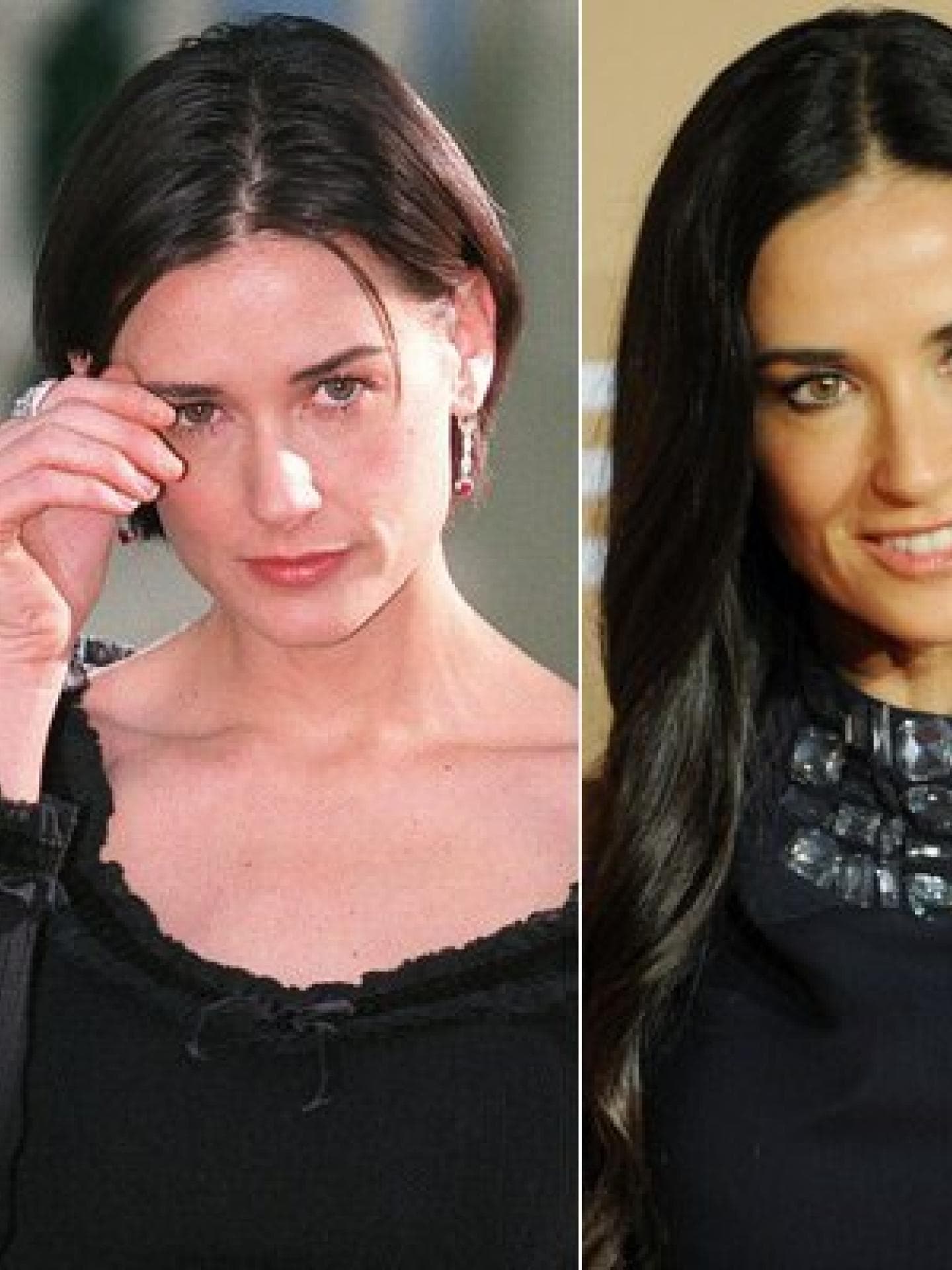 Demi Moore: Vorher-Nachher Demi Moore: Vorher-Nachher