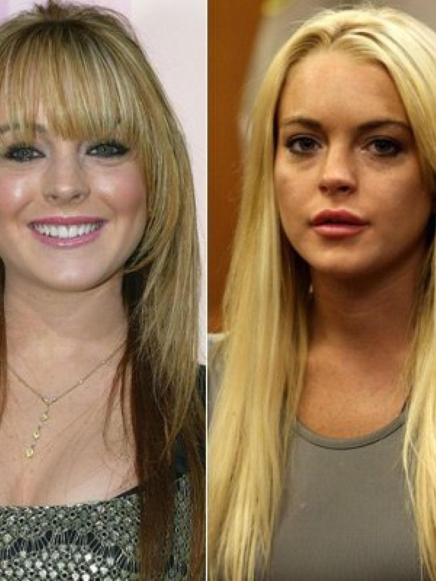 Lindsay Lohan: Vorher-Nachher Lindsay Lohan: Vorher-Nachher
