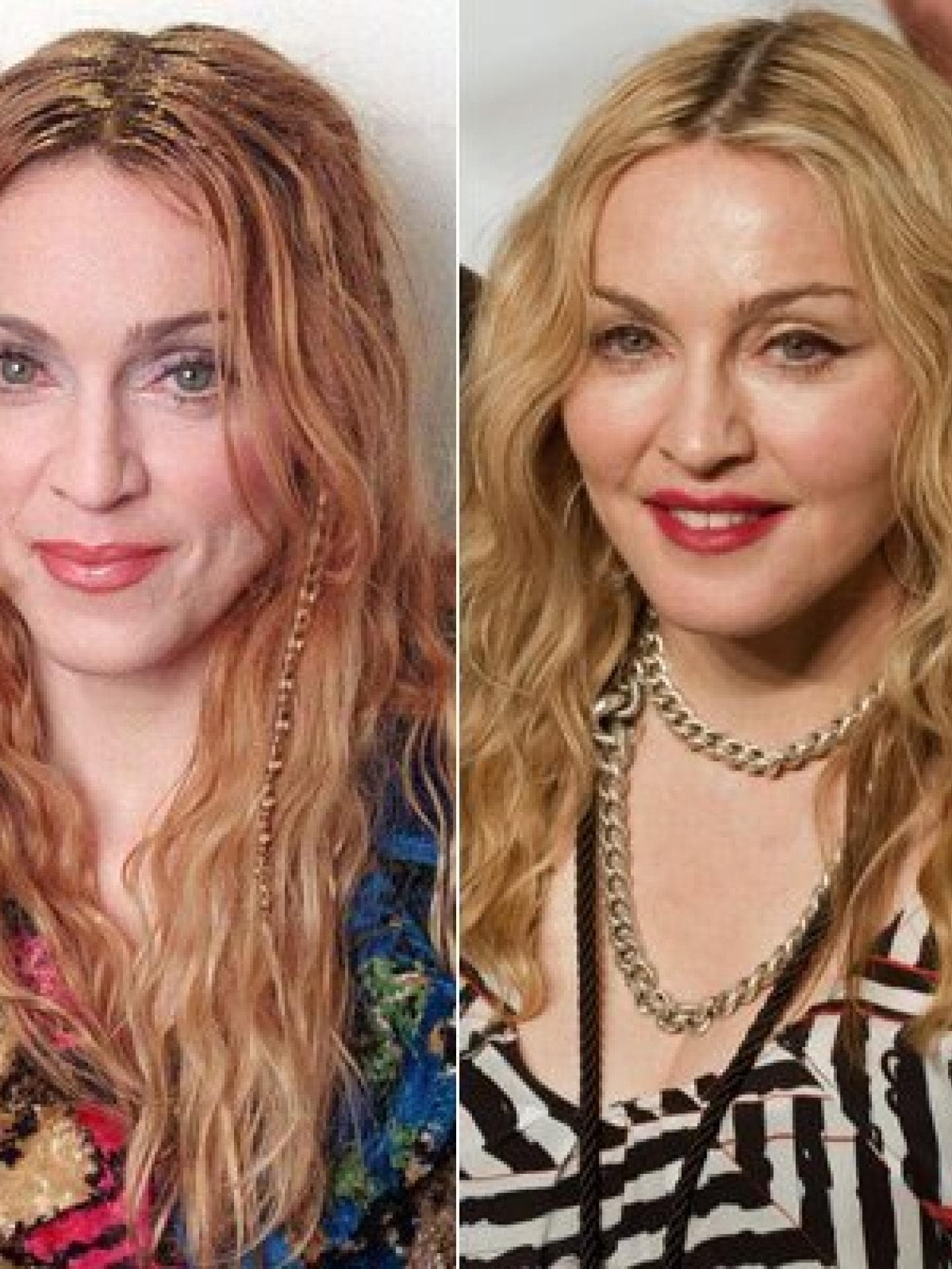 Madonna: Vorher-Nachher Madonna: Vorher-Nachher