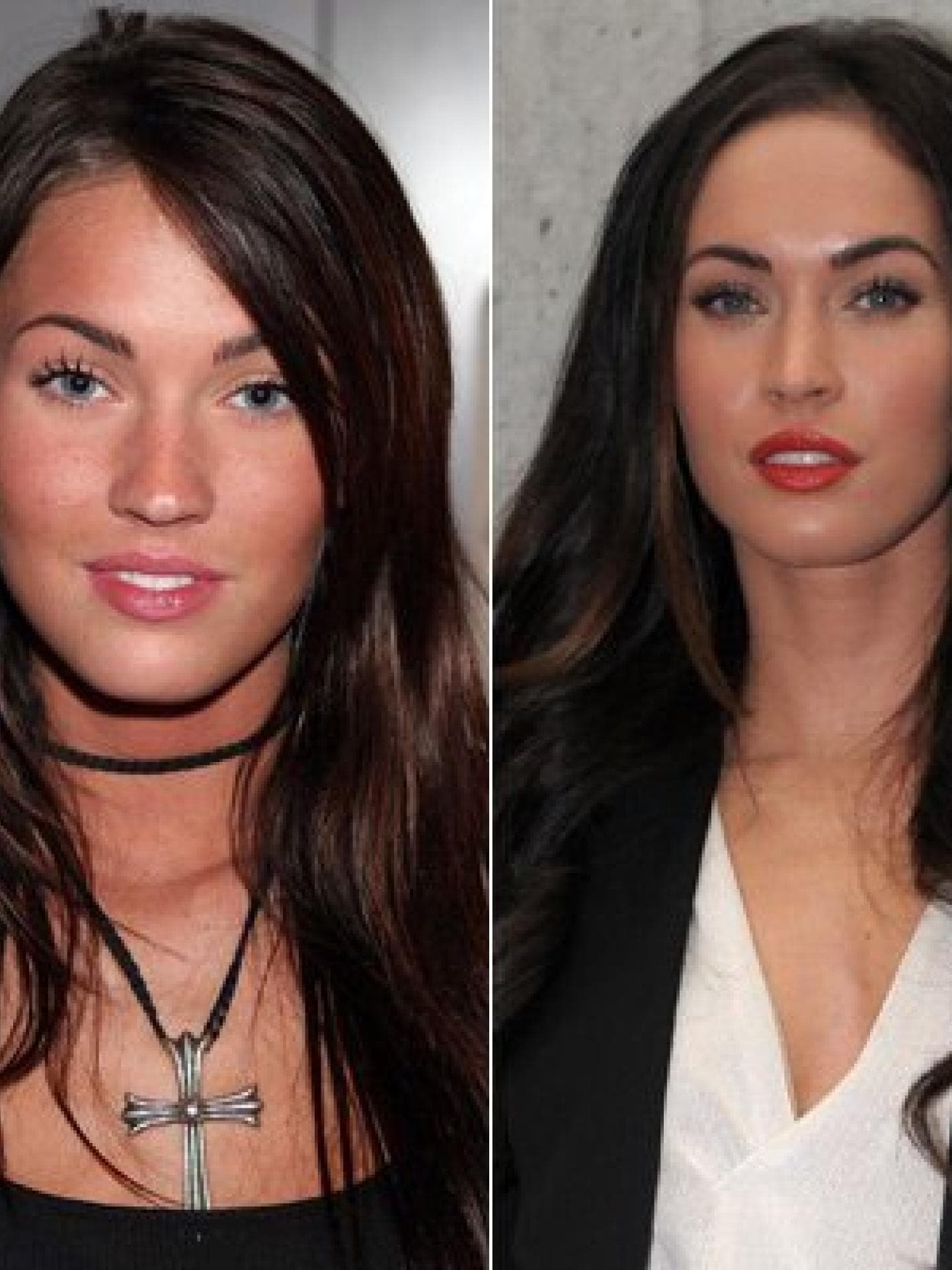 Megan Fox operiert? Megan Fox operiert?