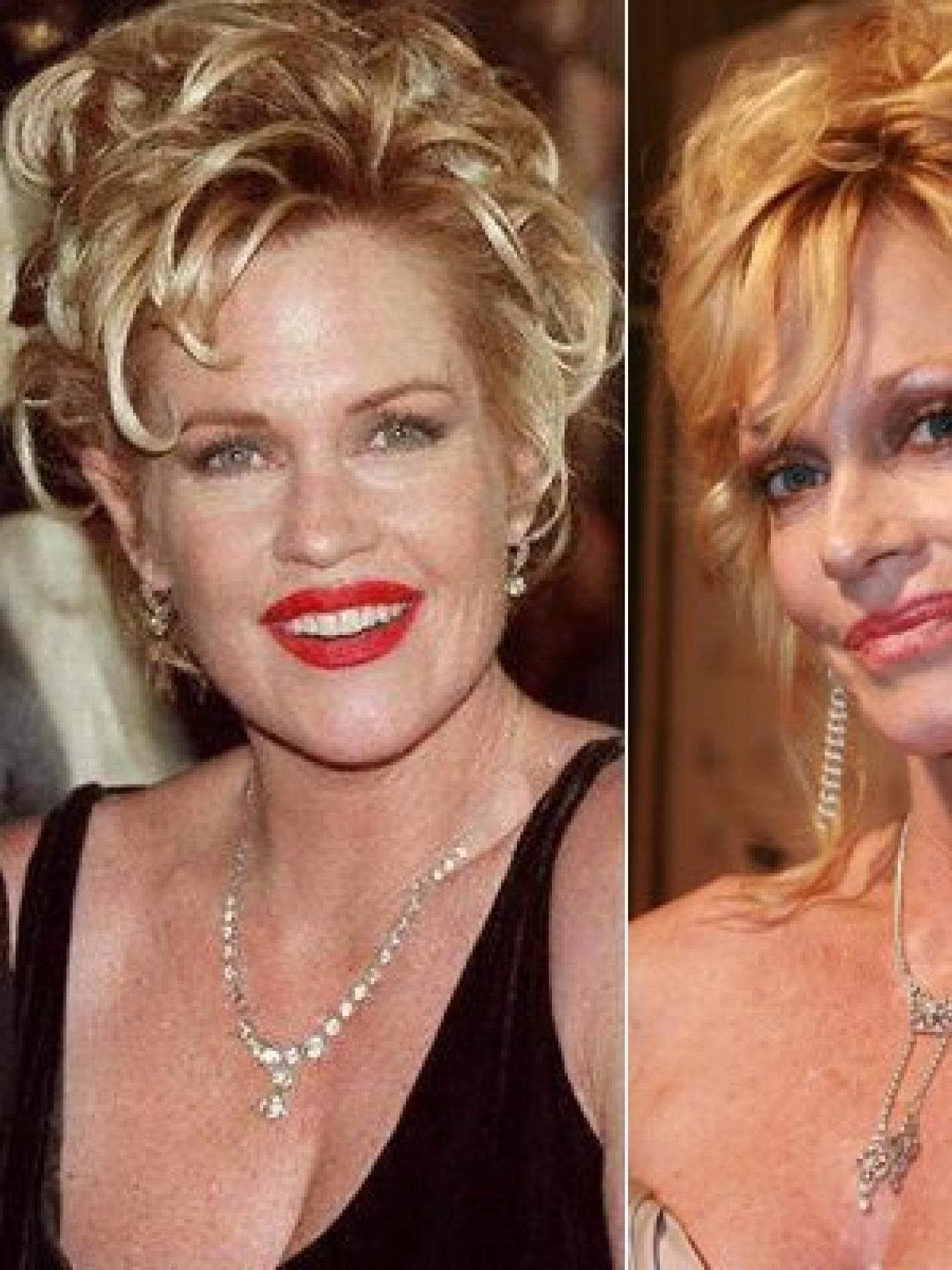 Melanie Griffith: Vorher-Nachher Melanie Griffith: Vorher-Nachher