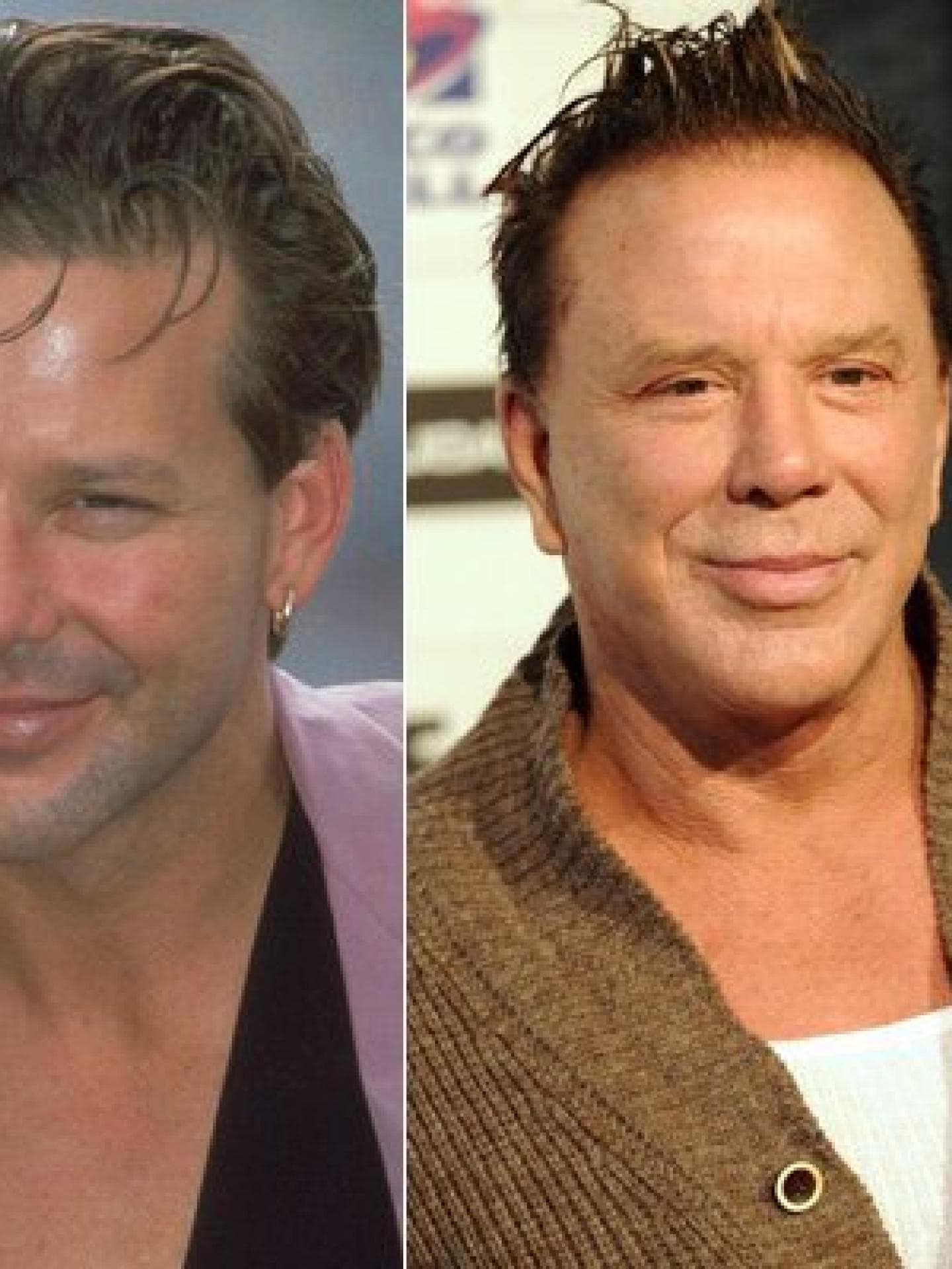 Mickey Rourke: Vorher-Nachher Mickey Rourke: Vorher-Nachher