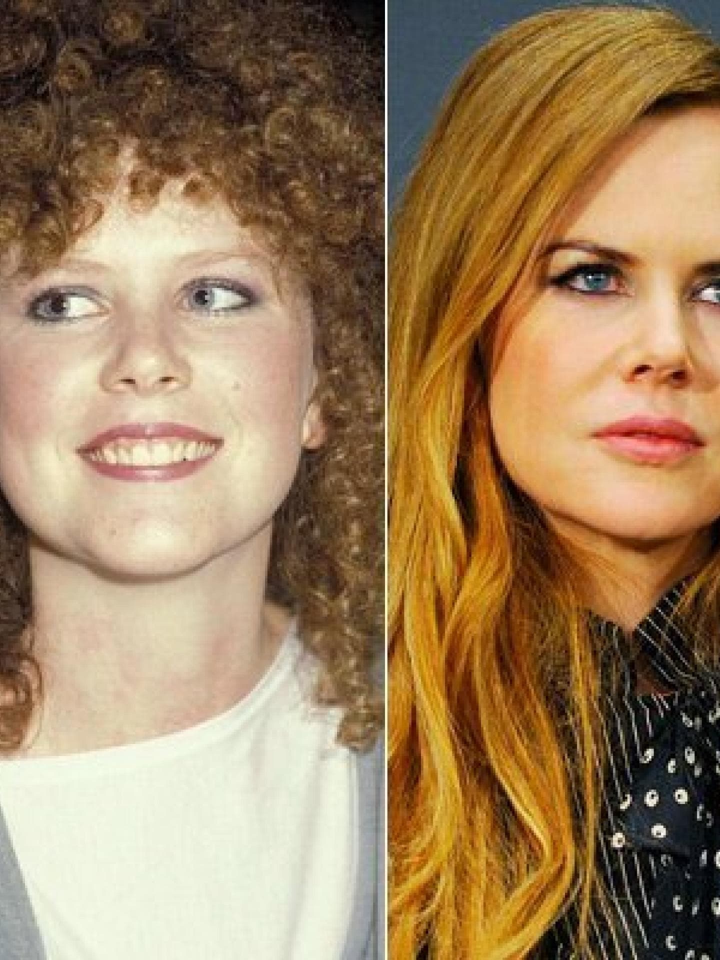 Nicole Kidman operiert? Nicole Kidman operiert?