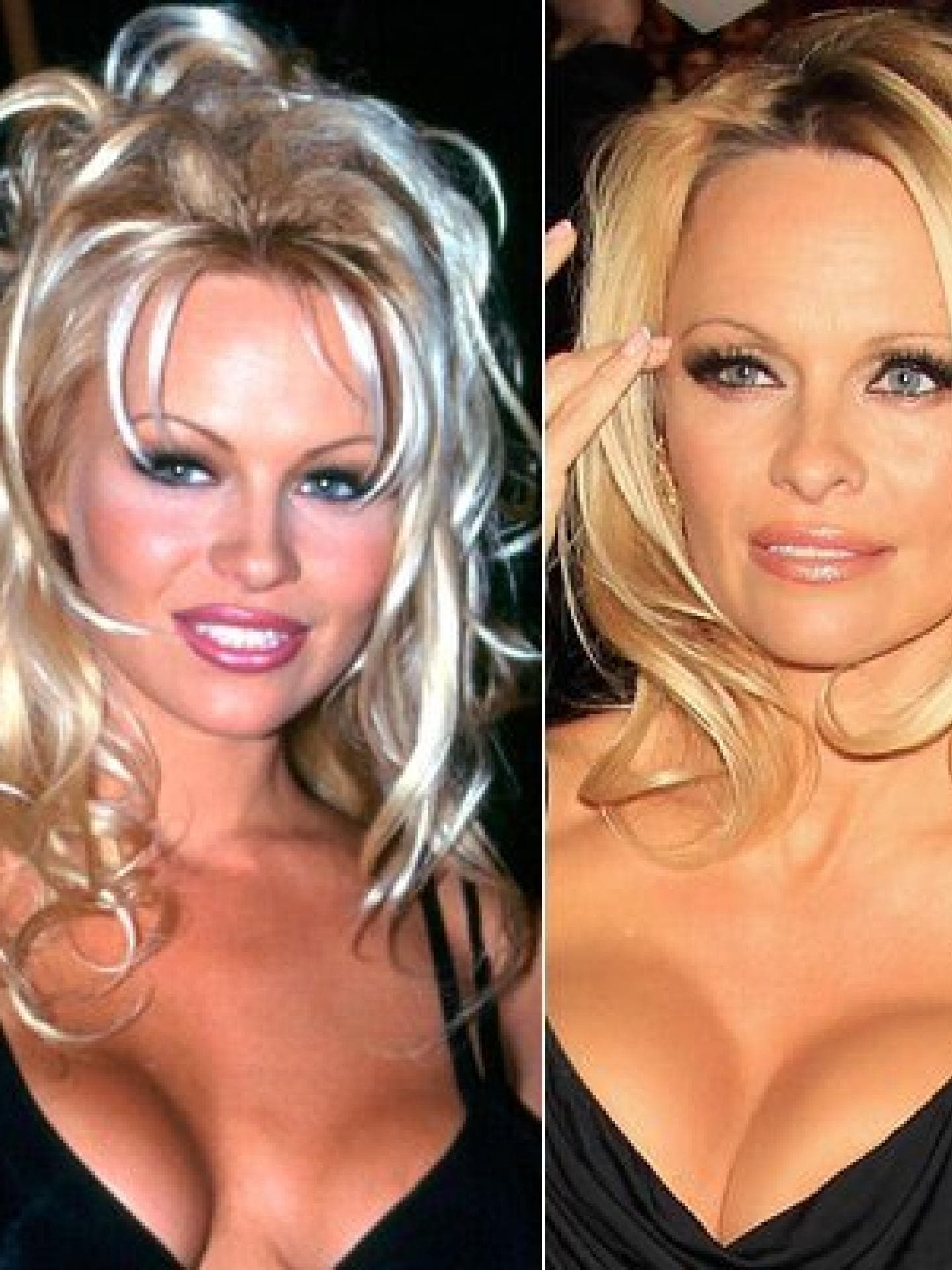Pamela Anderson operiert? Pamela Anderson operiert?