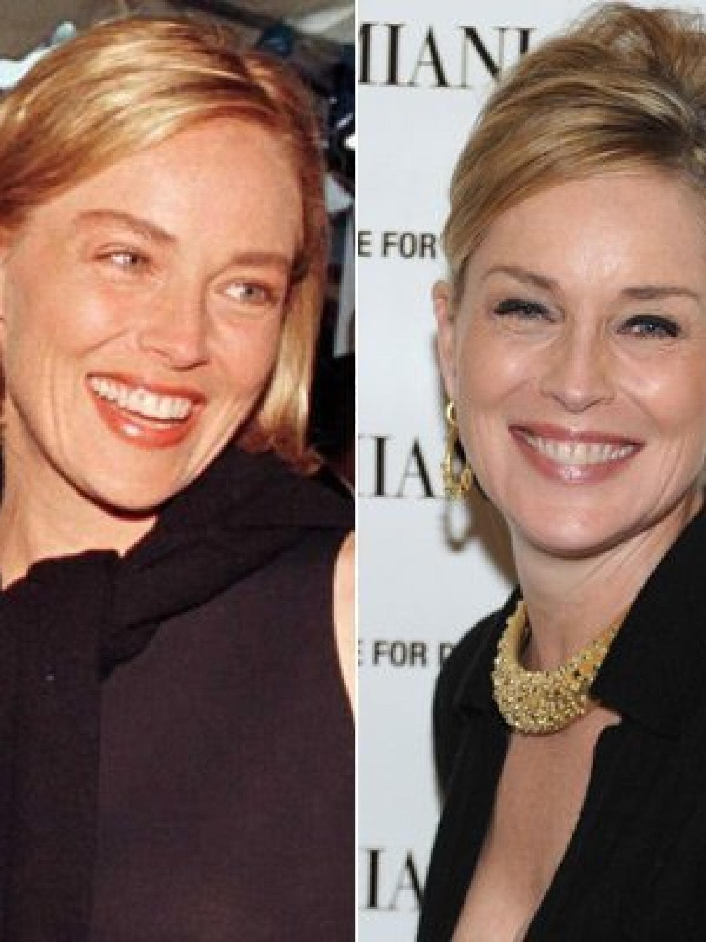 Sharon Stone: Vorher-Nachher Sharon Stone: Vorher-Nachher