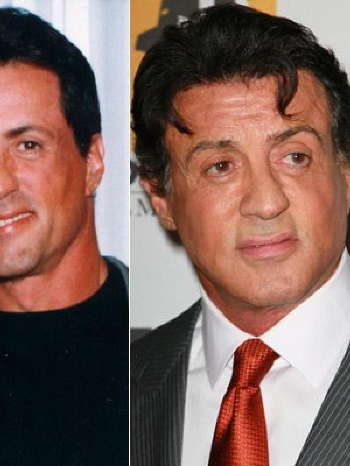 Silvester Stallone Schönheits-OP? Silvester Stallone Schönheits-OP?