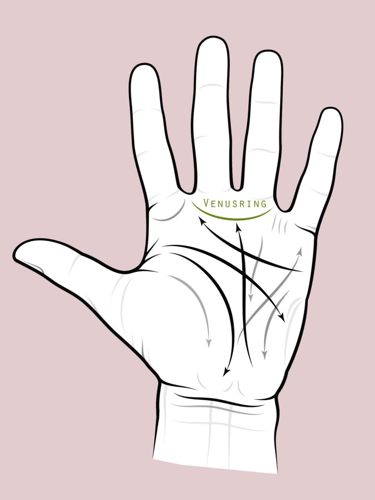 Venusring