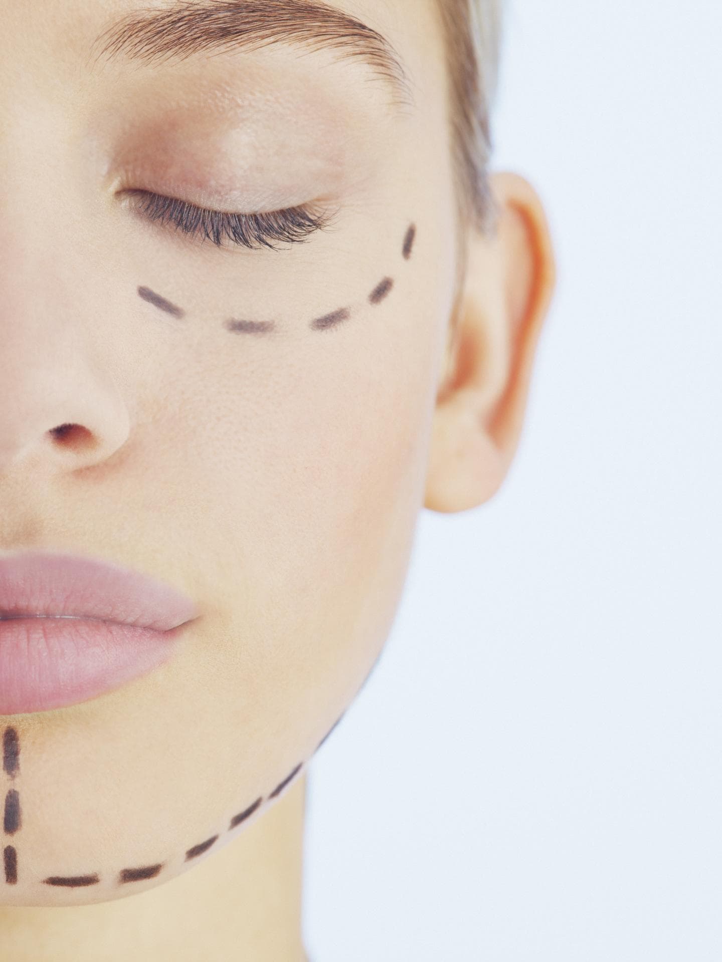 Frau mit Strichen vor Beauty OP im Gesicht
