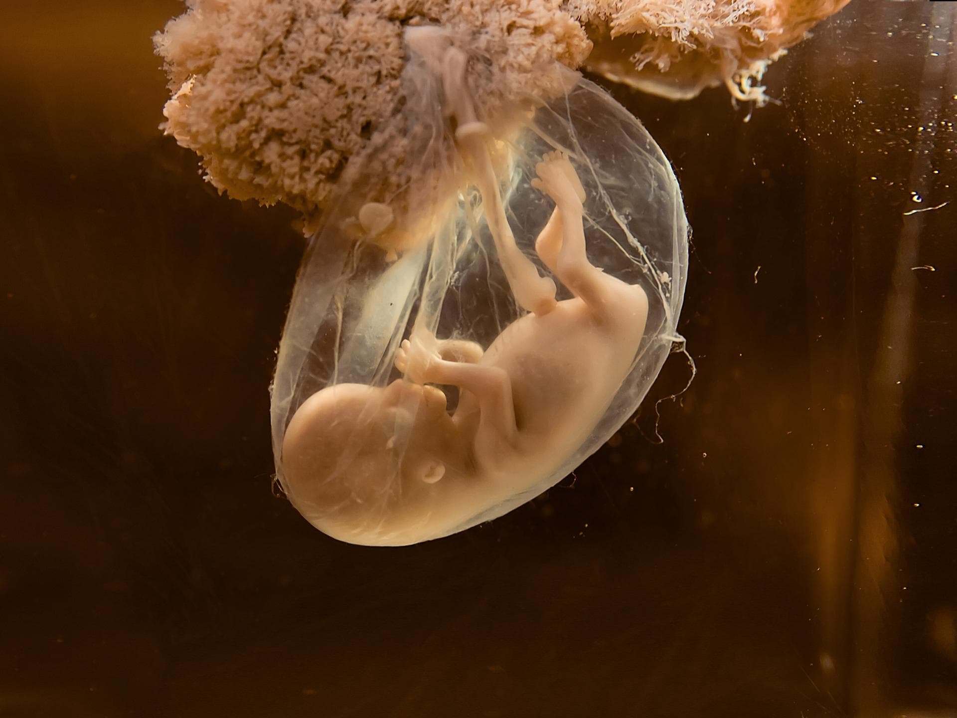 embryo ungeborenes kind