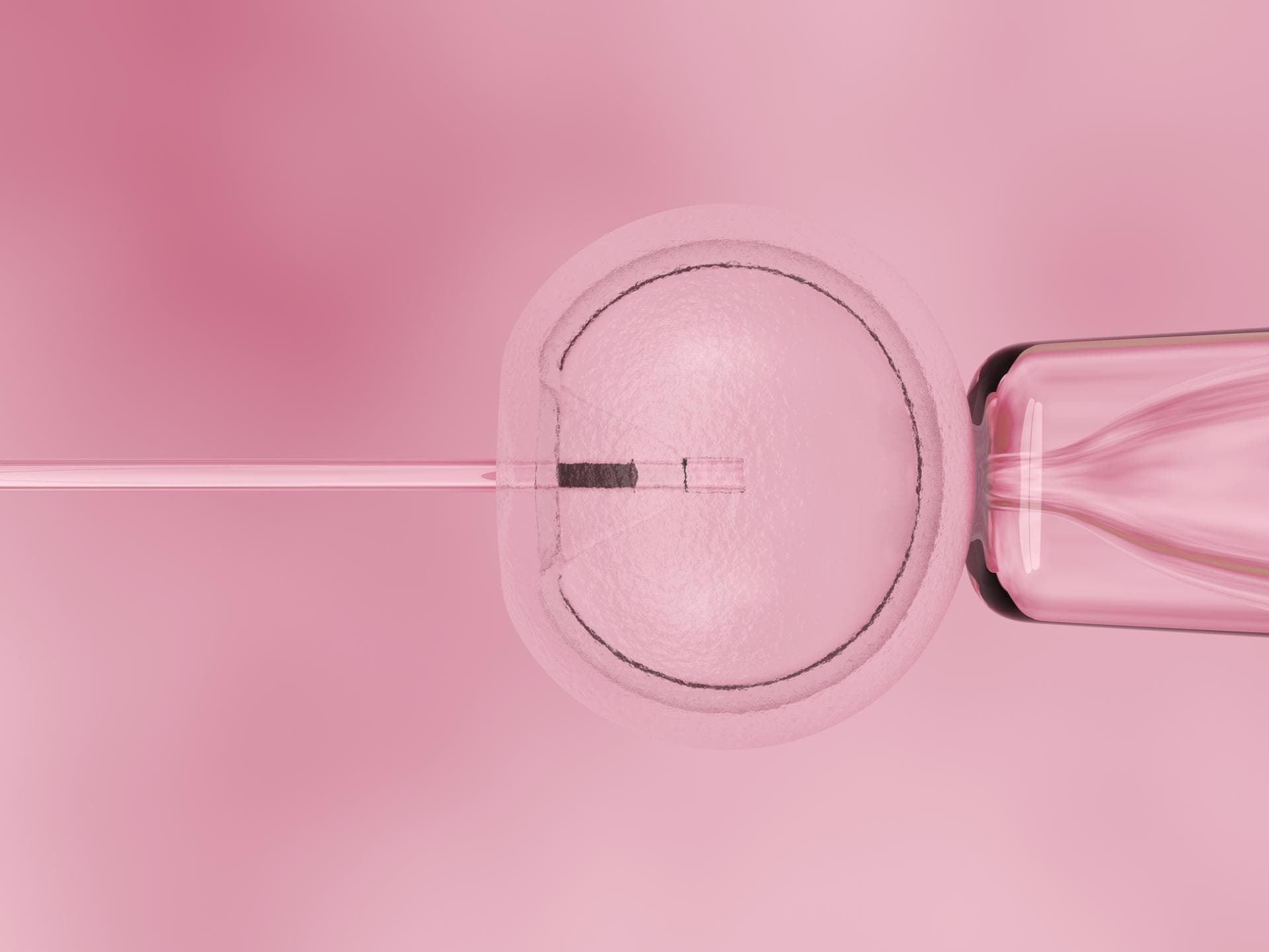 In-vitro-Fertilisation: Ablauf, Erfolgschancen und Kosten
