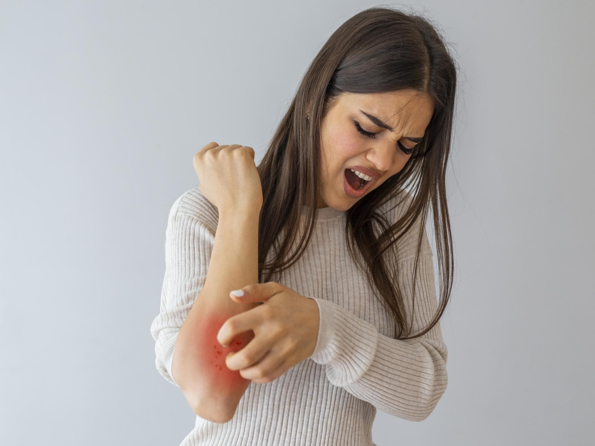 Frau kratzt sich am Arm